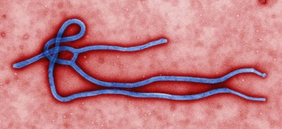 A microscopic image created by CDC microbiologist Cynthia Goldsmith shows the Ebola virus viron. (Photo from Wikipedia)