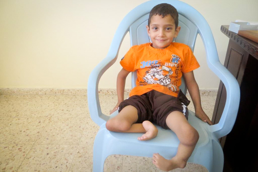 Weseem Shoulub, 7, resting in the Palestine Children's Relief Fund office in Gaza last year. Shoulub underwent surgery to amputate both legs at Spokane Shriners Hospital on October 7th. (Photo courtesy PCRF)